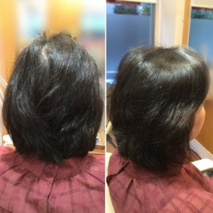 表面・顔周りツヤツヤプログラム Before